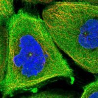 Anti-TCHP antibody produced in rabbit 