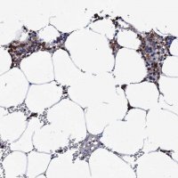 Anti-TCIRG1 antibody produced in rabbit 