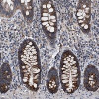Anti-TECPR1 antibody produced in rabbit