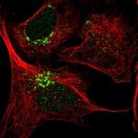 Anti-THAP2 antibody produced in rabbit 