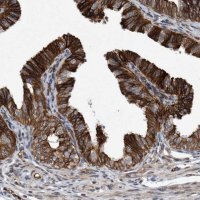 Anti-THEM6 antibody produced in rabbit 