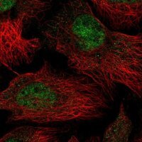 Anti-THOC5 antibody produced in rabbit