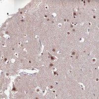 Anti-THOC7 antibody produced in rabbit 