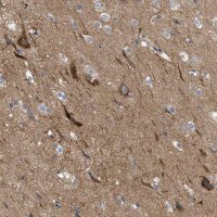 Anti-THRA antibody produced in rabbit 