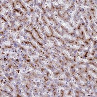 Anti-THRSP antibody produced in rabbit 