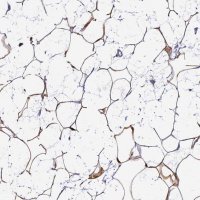 Anti-THRSP antibody produced in rabbit 