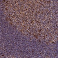 Anti-THUMPD2 antibody produced in rabbit 