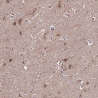 Anti-TIGAR antibody produced in rabbit