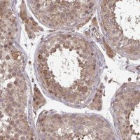 Anti-TIGAR antibody produced in rabbit