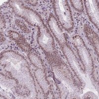Anti-TIGD1 antibody produced in rabbit 