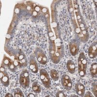 Anti-TIMM17B antibody produced in rabbit 