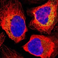 Anti-TIMM8A antibody produced in rabbit