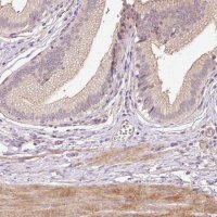 Anti-TIRAP antibody produced in rabbit