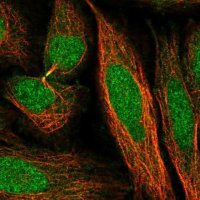 Anti-TIRAP antibody produced in rabbit
