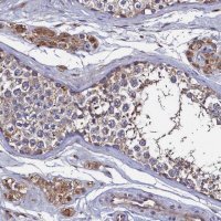 Anti-TK2 antibody produced in rabbit