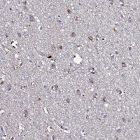 Anti-TK2 antibody produced in rabbit