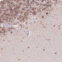 Anti-TLE2 antibody produced in rabbit 