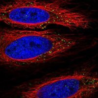 Anti-TLL1 antibody produced in rabbit HPA060767-100UL