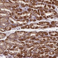 Anti-TM2D3 antibody produced in rabbit 