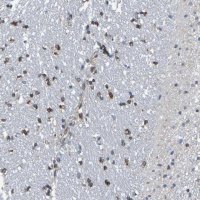 Anti-TMCC3 antibody produced in rabbit 