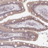 Anti-TMED5 antibody produced in rabbit 