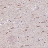 Anti-TMEM100 antibody produced in rabbit