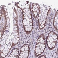 Anti-TMEM108 antibody produced in rabbit 