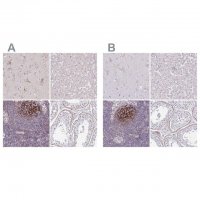 Anti-TMEM119 antibody produced in rabbit