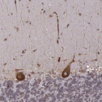 Anti-TMEM14A antibody produced in rabbit 