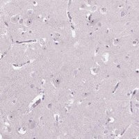 Anti-TMEM151B antibody produced in rabbit