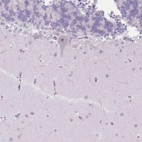 Anti-TMEM151B antibody produced in rabbit