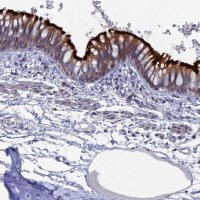 Anti-TMEM161A antibody produced in rabbit