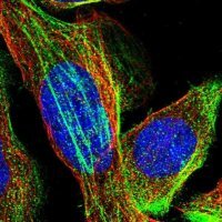 Anti-TMEM17 antibody produced in rabbit HPA018100-100UL