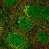 Anti-TMEM176B antibody produced in rabbit 