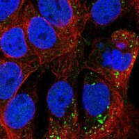 Anti-TMEM182 antibody produced in rabbit