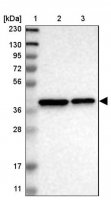 Anti-TMEM19 antibody produced in rabbit HPA016830-100UL