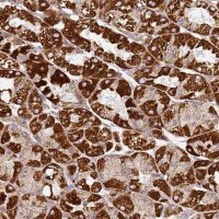 Anti-TMEM200C antibody produced in rabbit 