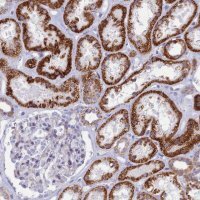 Anti-TMEM206 antibody produced in rabbit