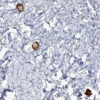 Anti-TMEM209 antibody produced in rabbit