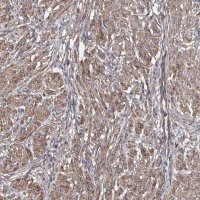 Anti-TMEM218 antibody produced in rabbit 
