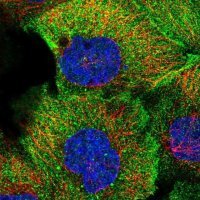 Anti-TMEM218 antibody produced in rabbit 