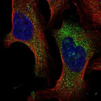 Anti-TMEM222 antibody produced in rabbit 