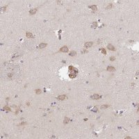 Anti-TMEM229A antibody produced in rabbit 