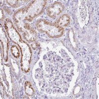 Anti-TMEM246 antibody produced in rabbit 