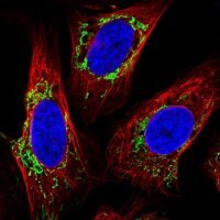 Anti-TMEM246 antibody produced in rabbit 