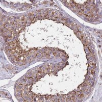 Anti-TMEM255B antibody produced in rabbit HPA043334-100UL
