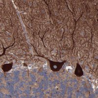 Anti-TMEM268 antibody produced in rabbit 