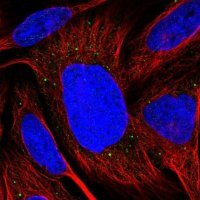 Anti-TMEM39B antibody produced in rabbit 