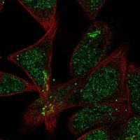 Anti-TMEM86A antibody produced in rabbit 