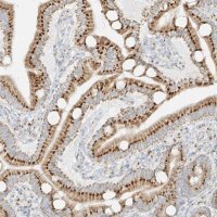 Anti-TMEM87B antibody produced in rabbit HPA035183-100UL